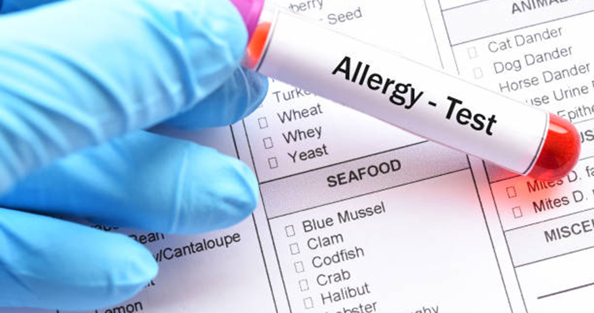 Mr. George Grech - Allergy Testing